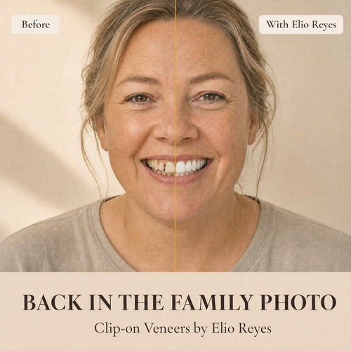 Clip-On Veneers by Elio Reyes